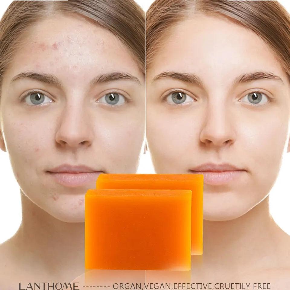 Savon anti dรฉpigmentation KOJIC ACID