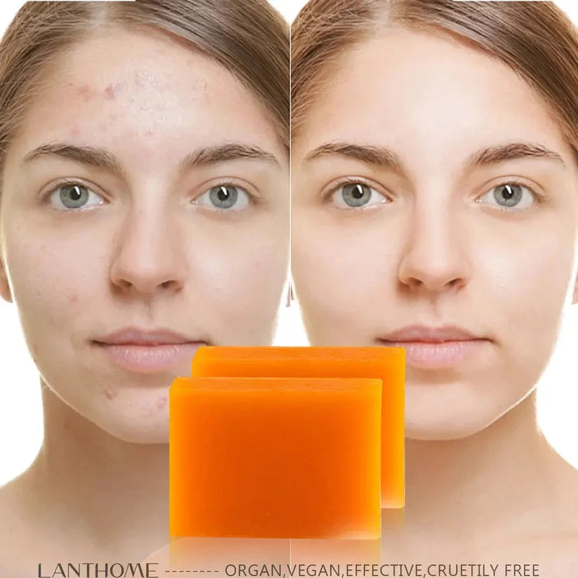 Savon anti dรฉpigmentation KOJIC ACID