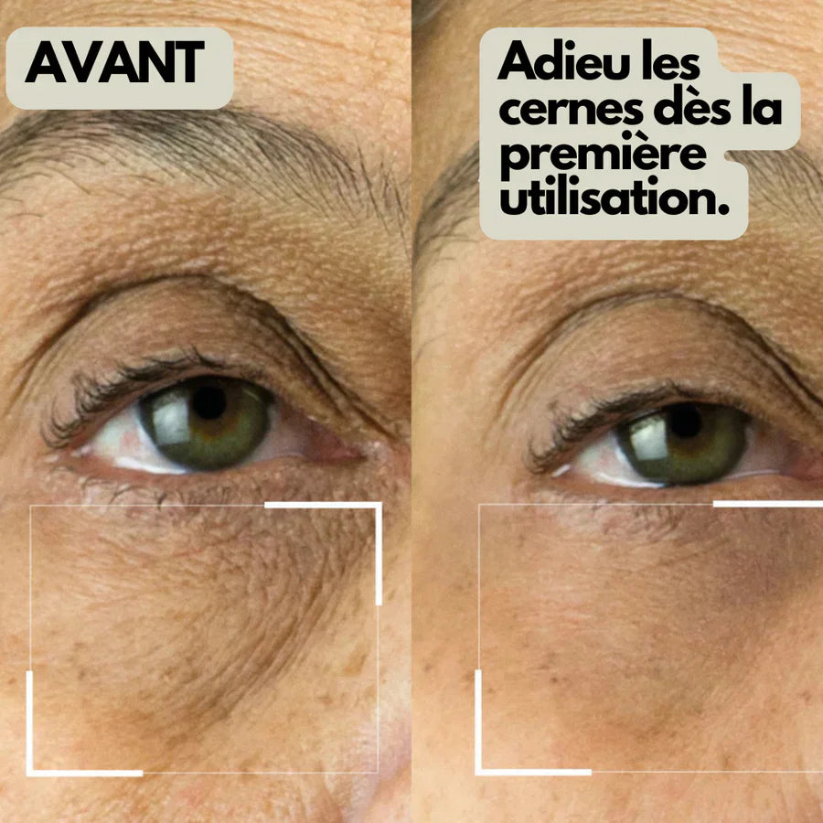 CONCEALER CREAM