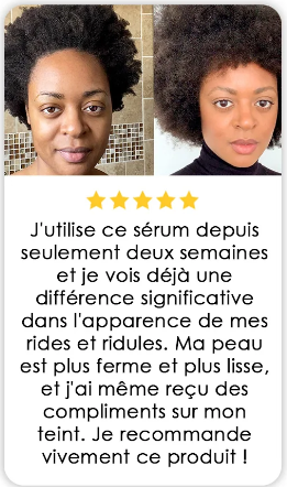 The ordinary serum (Niacinamide)
