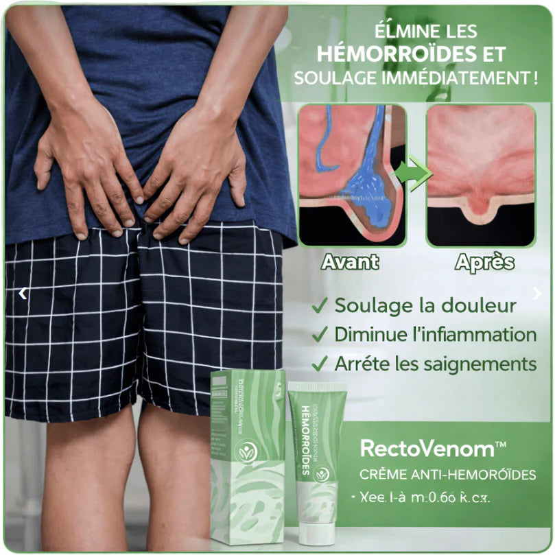 RectoVenom™ Crème Anti-Hémorroïdes | Traite 99% des hémorroïdes dès la première application!