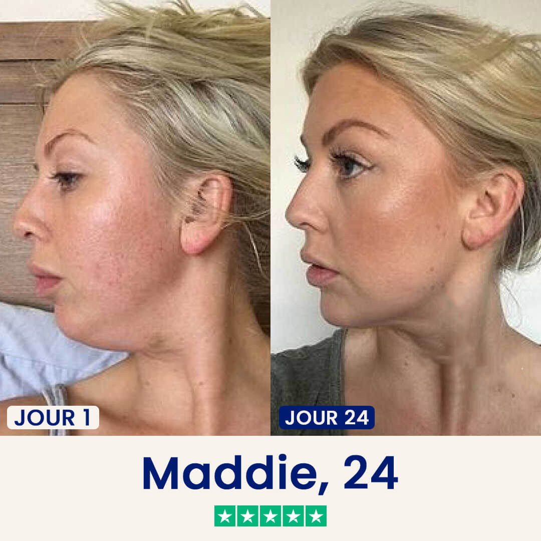 Le Masque Lift : Dites adieu à votre double menton dès maintenant.
