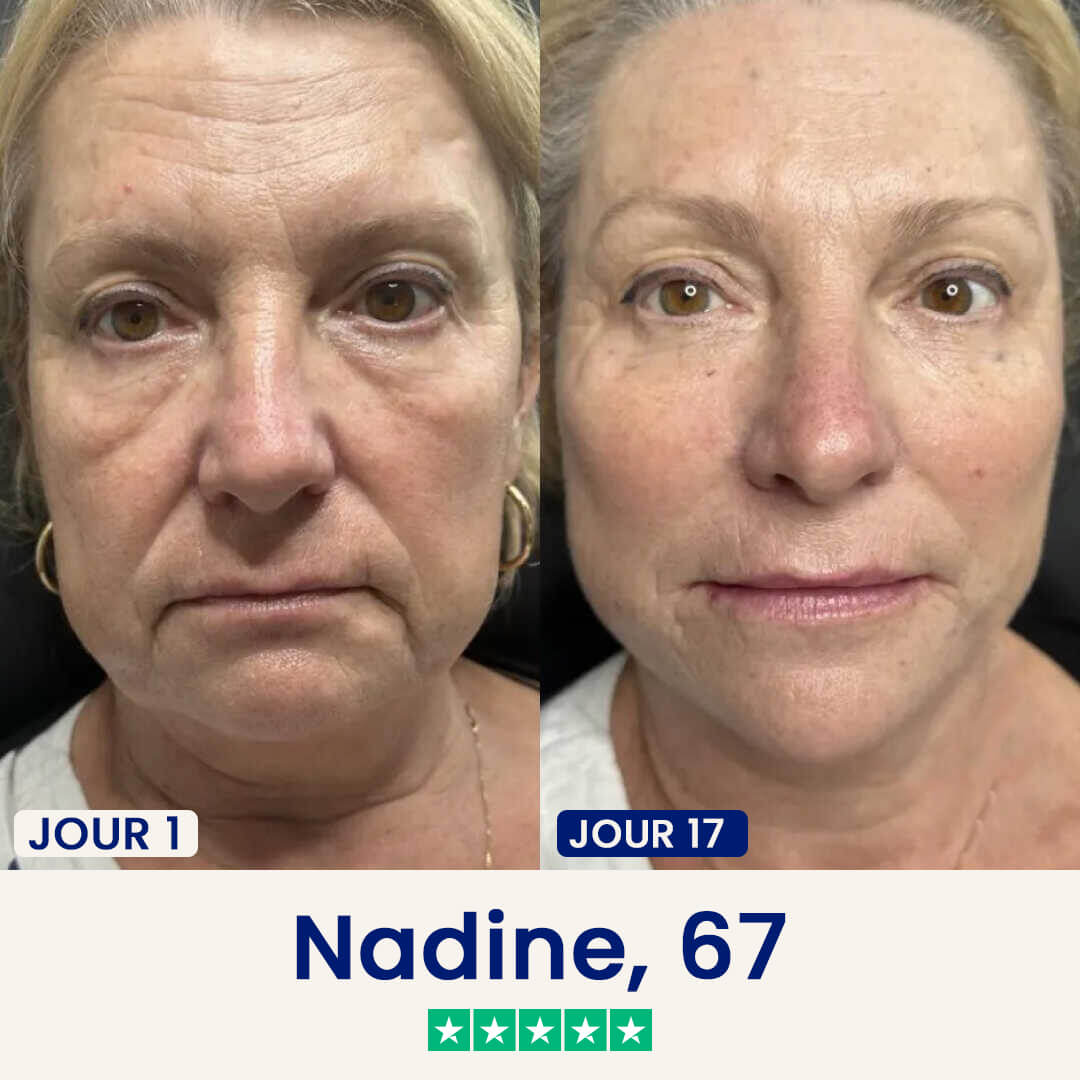 Le Masque Lift : Dites adieu à votre double menton dès maintenant.