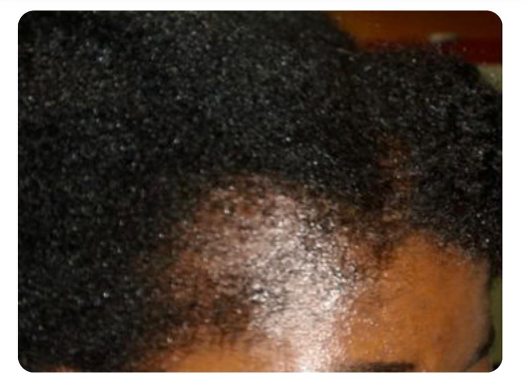 Batana Pure : Boosteur de croissance