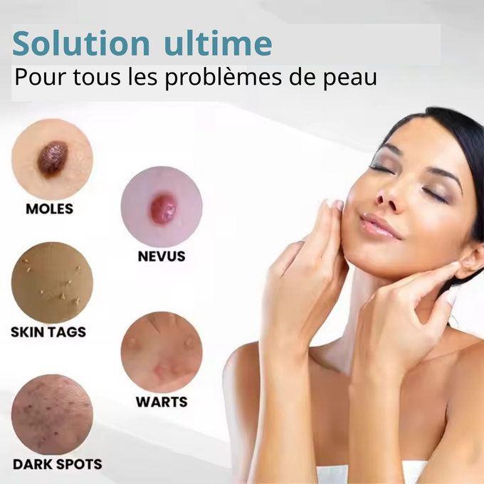 Stylo Laser ProMax – Grains & Verrues