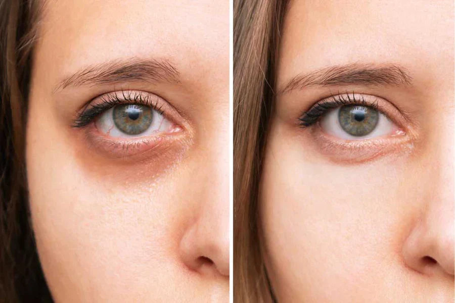CONCEALER CREAM