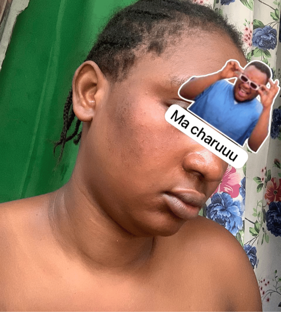 Savon anti - taches au curcuma | 100% Naturel (GB)