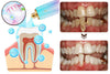 Dentifrice au Niacinamide - Souriez en toute confiance BODYARCEL