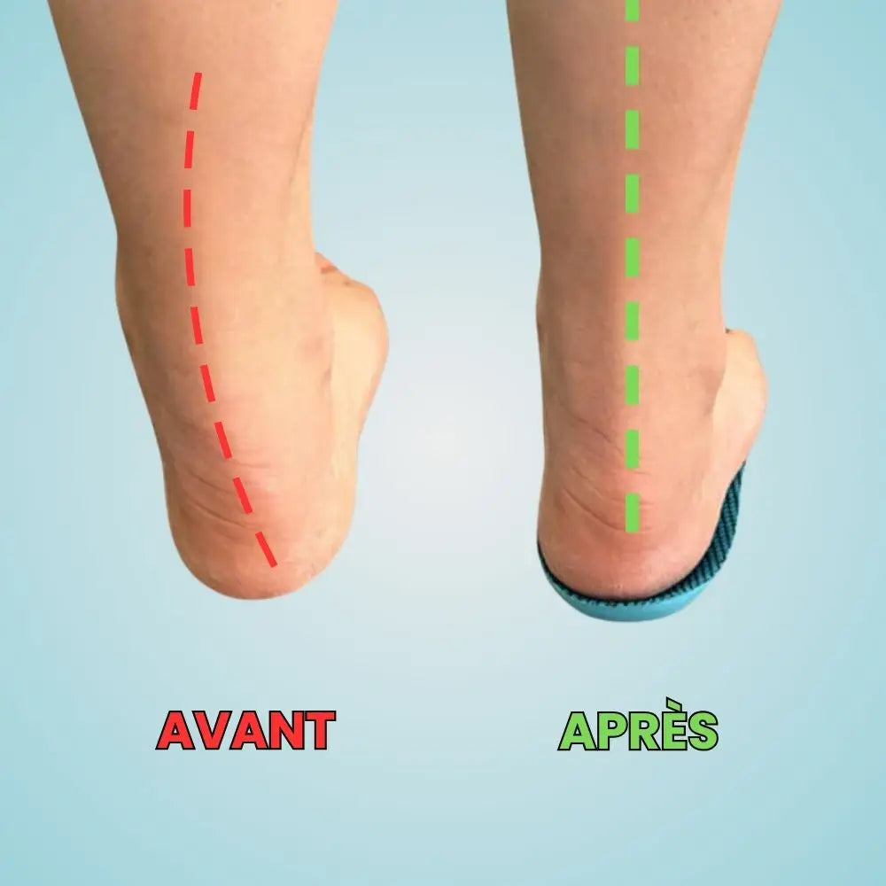 Semelles OrthoFlex™ - Une journée entière sans douleur