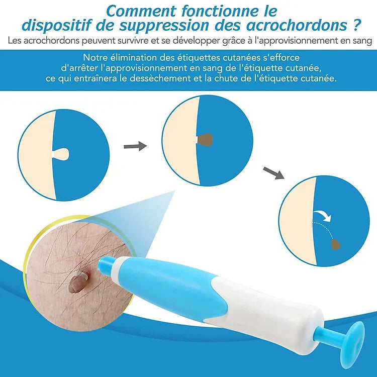 Kit DermaSkin Pro™ – Adieu Les Acrochordons, Résultat Immédiat BN