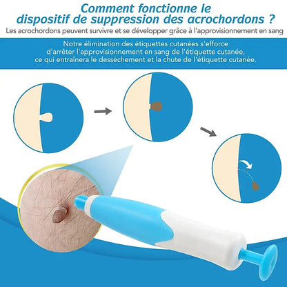 Kit DermaSkin Pro™ – Adieu Les Acrochordons, Résultat Immédiat BN