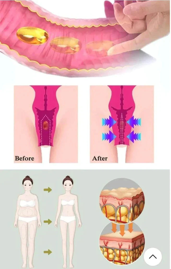 Gélules BioNaturelles de réparation vaginale