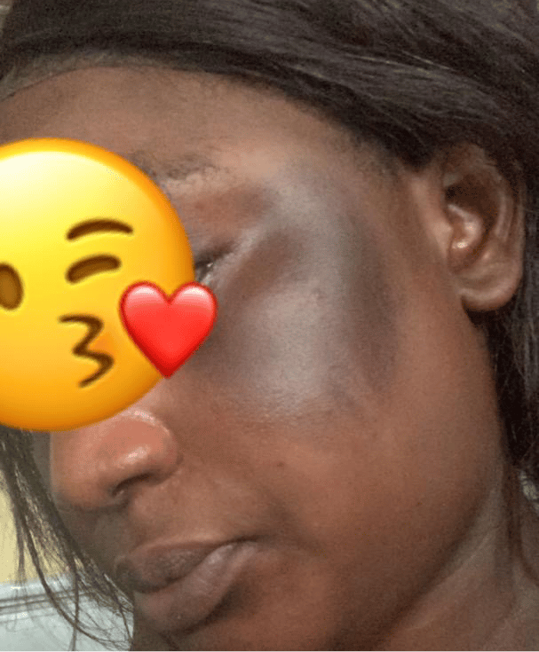 Savon anti - taches au curcuma | 100% Naturel (GB)