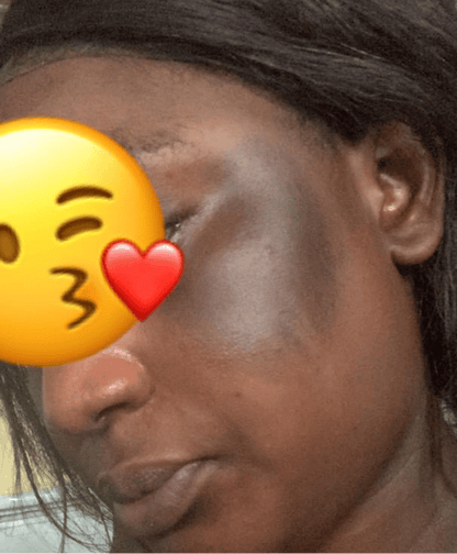 Savon anti - taches au curcuma | 100% Naturel (GB)