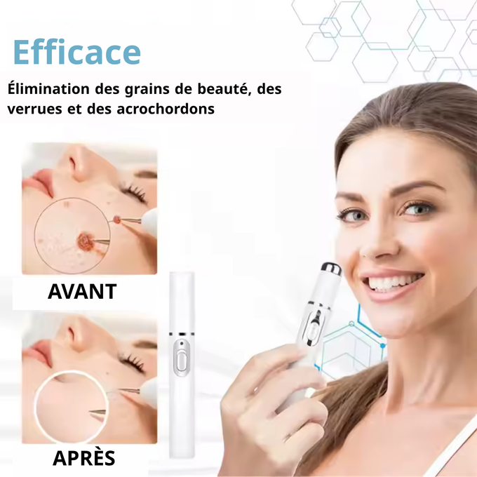 Stylo Laser ProMax – Grains & Verrues