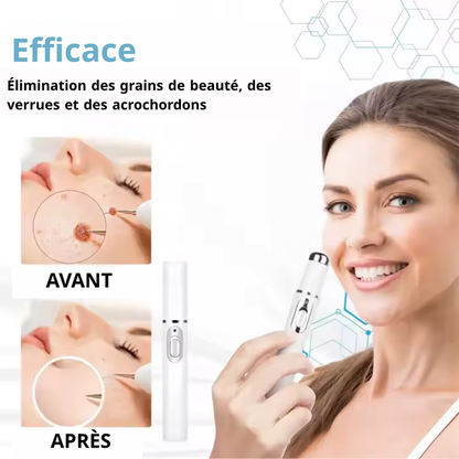 Stylo Laser ProMax – Grains & Verrues