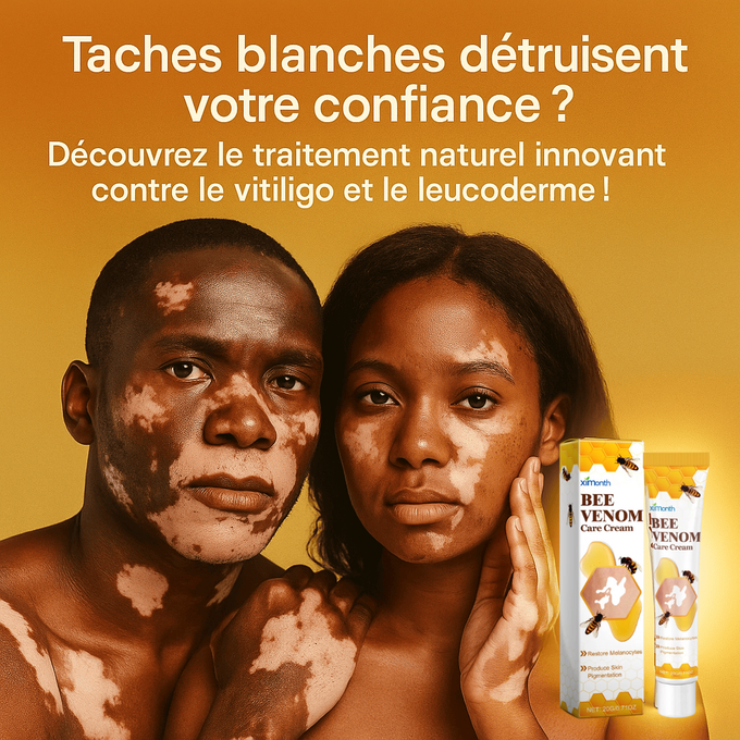 Fini la gêne à cause des taches blanches… Récupérez votre teint naturellement ! - Crème Bee Venom (bn)