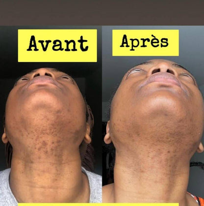 Savon anti - taches au curcuma | 100% Naturel (GB)