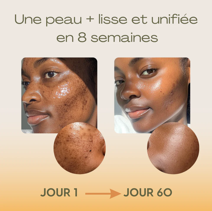 Routine Anti-Imperfections 4 en 1