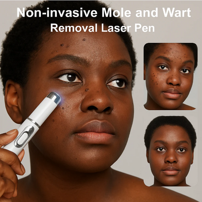 Stylo Laser ProMax – Grains & Verrues