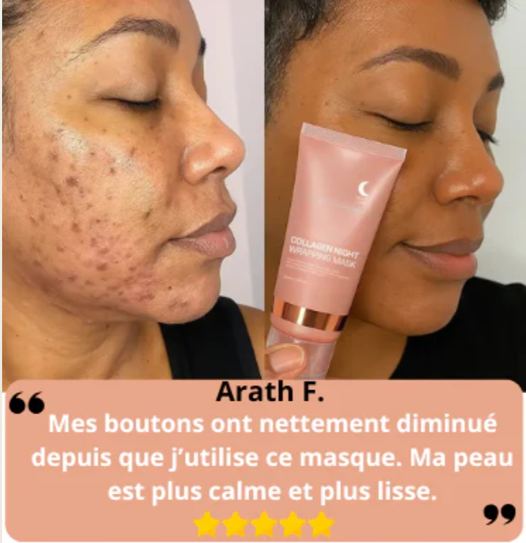 Masque au collagène (BKF)