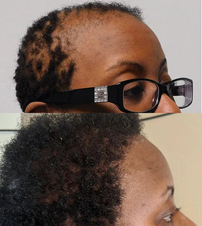 Huile de Batana Akunado