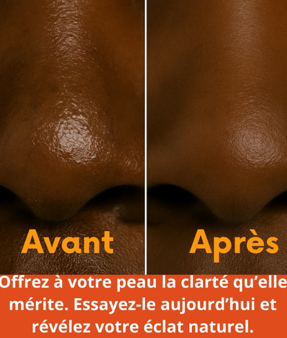 Patchs Nez Purifiants(10 Patchs)