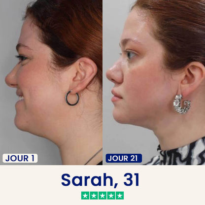 Le Masque Lift : Dites adieu à votre double menton dès maintenant.