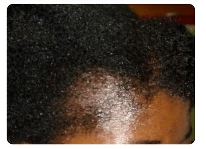 Batana Pure : Boosteur de croissance