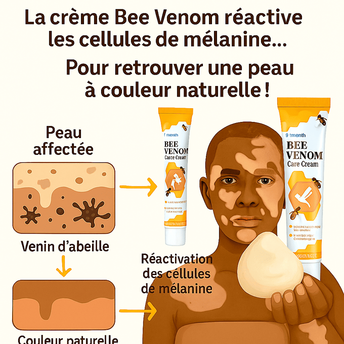 Fini la gêne à cause des taches blanches… Récupérez votre teint naturellement ! - Crème Bee Venom (bn)