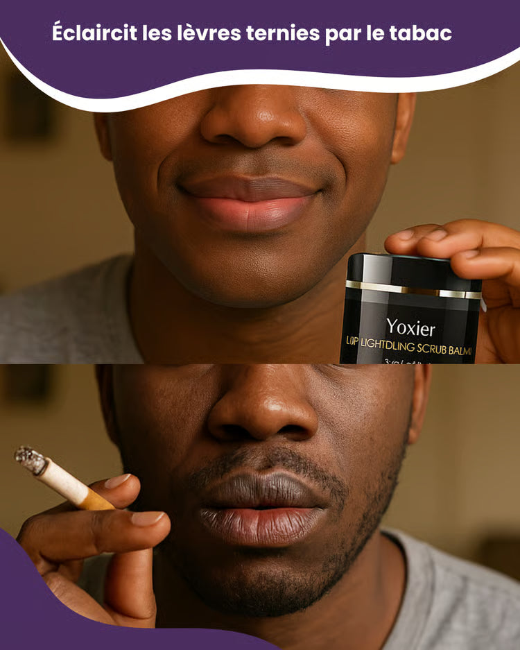 Yoxier™ | Sérum éclaircissant pour lèvres foncée ou ternies par le tabac BN