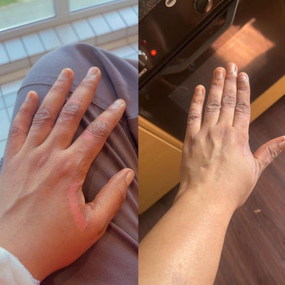 Savon anti - taches au curcuma | 100% Naturel (GB)