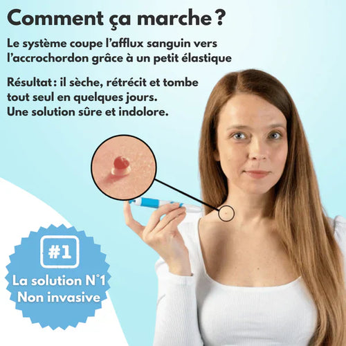 Kit DermaSkin Pro™ – Adieu Les Acrochordons, Résultat Immédiat BN
