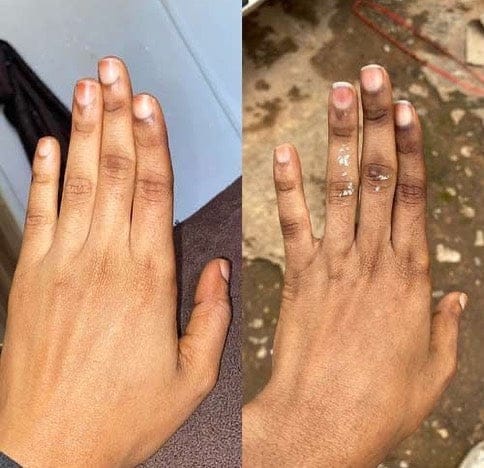 Savon anti - taches au curcuma | 100% Naturel (GB)