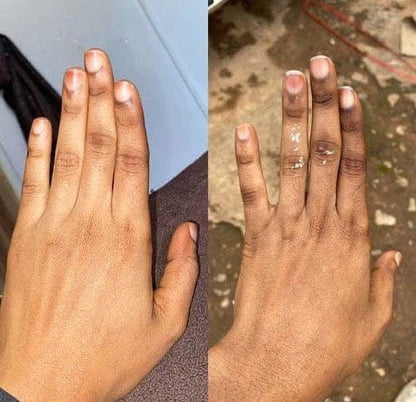 Savon anti - taches au curcuma | 100% Naturel (GB)