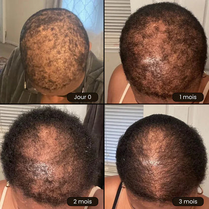 Huile de Batana Akunado