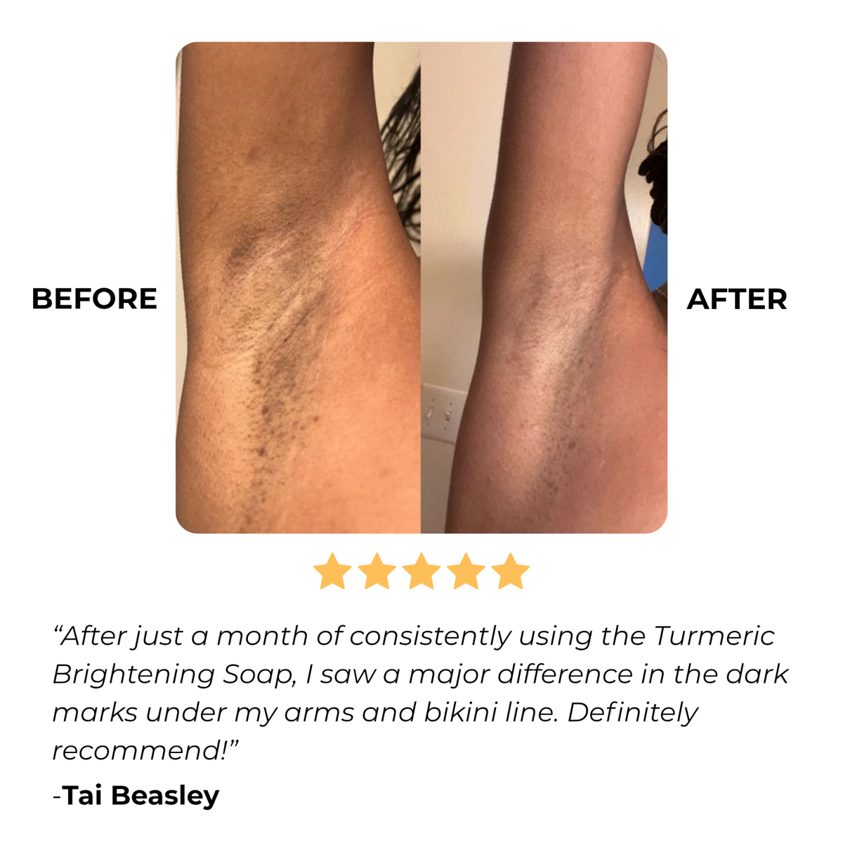 Turmeric Brightening Soap (with Vitamin C, Alpha Arbutin, Oat) 