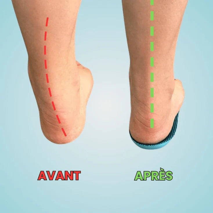 Semelles OrthoFlex™ - Une journée entière sans douleur