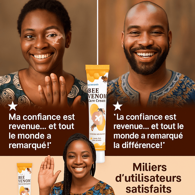 Fini la gêne à cause des taches blanches… Récupérez votre teint naturellement ! - Crème Bee Venom (bn)